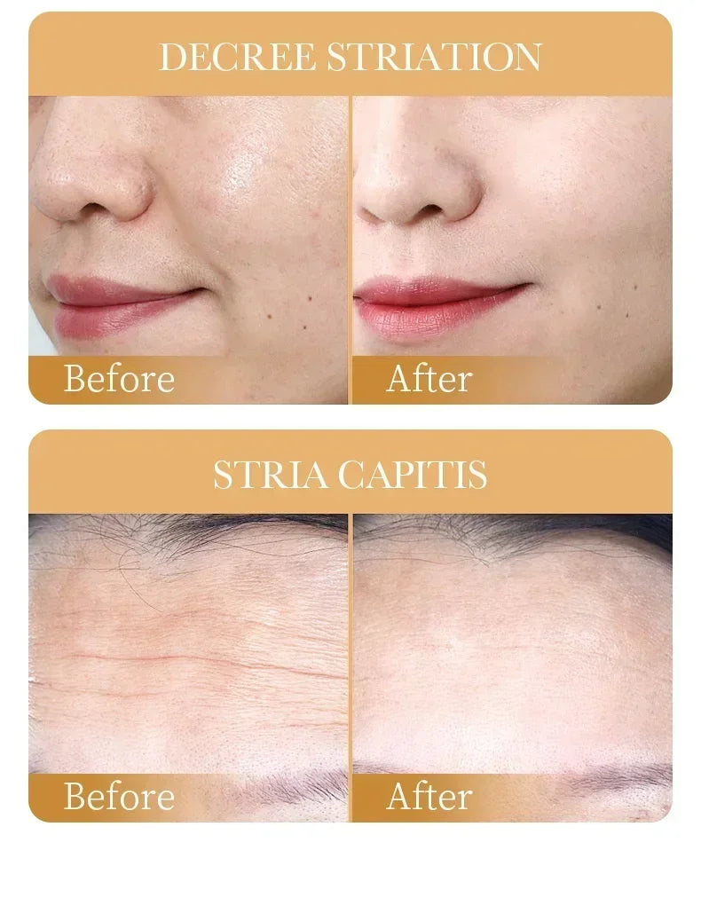 Masque Facial au Collagène SADOER