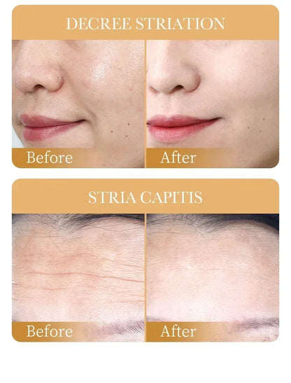 Masque Facial au Collagène SADOER